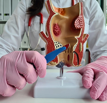 Anal fissure, anal fistula